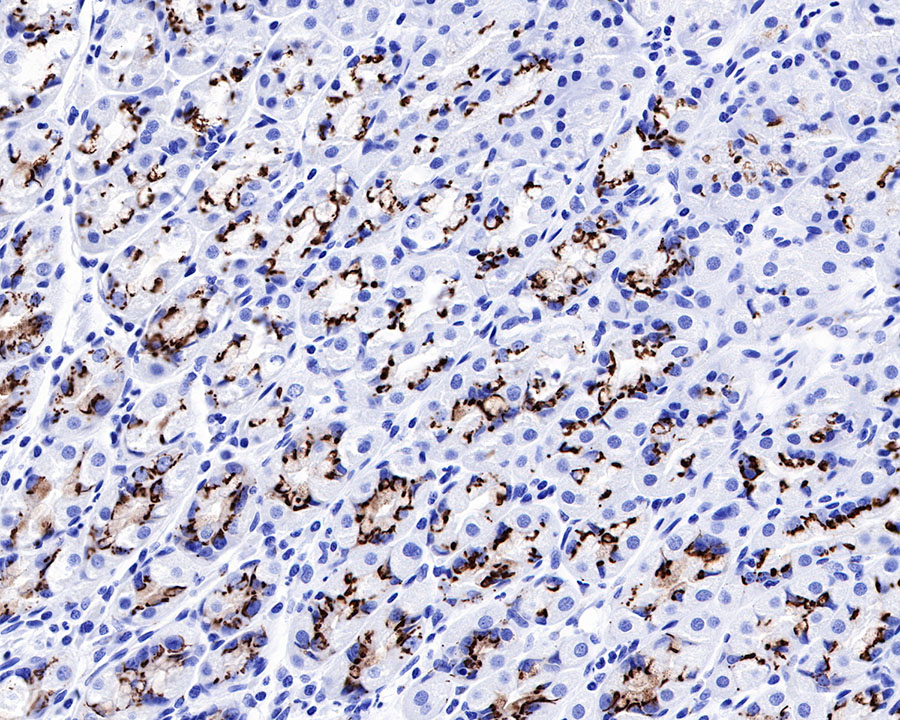 Rabbit anti-GP73/GOLPH2 Recombinant Monoclonal Antibody(231-102)