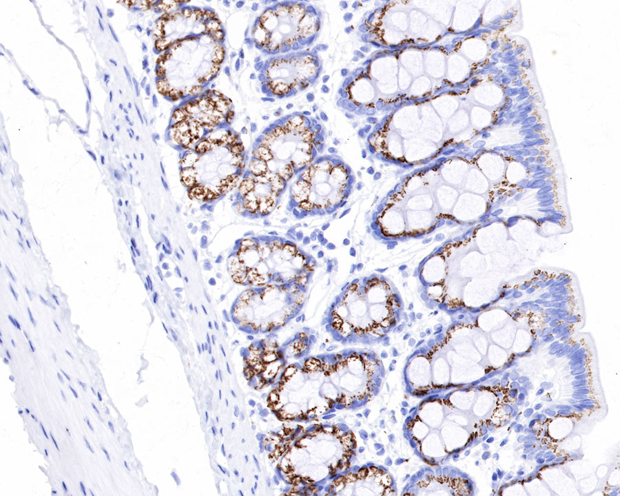 Rabbit anti-GP73/GOLPH2 Recombinant Monoclonal Antibody(231-102)