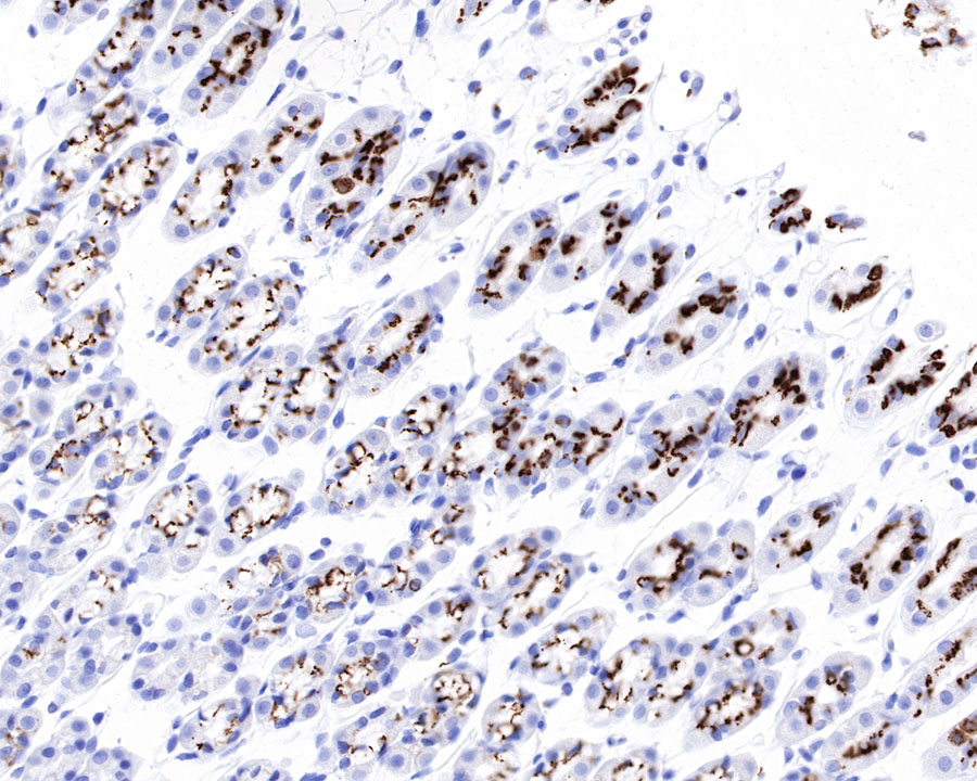 Rabbit anti-GP73/GOLPH2 Recombinant Monoclonal Antibody(231-102)