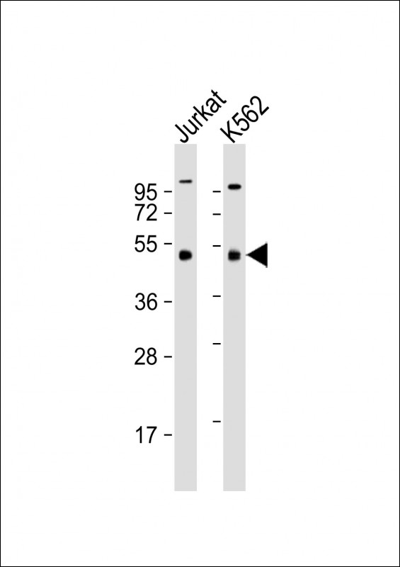 Mouse anti-MKRN2 Monoclonal Antibody(1556CT631.230.55.49)