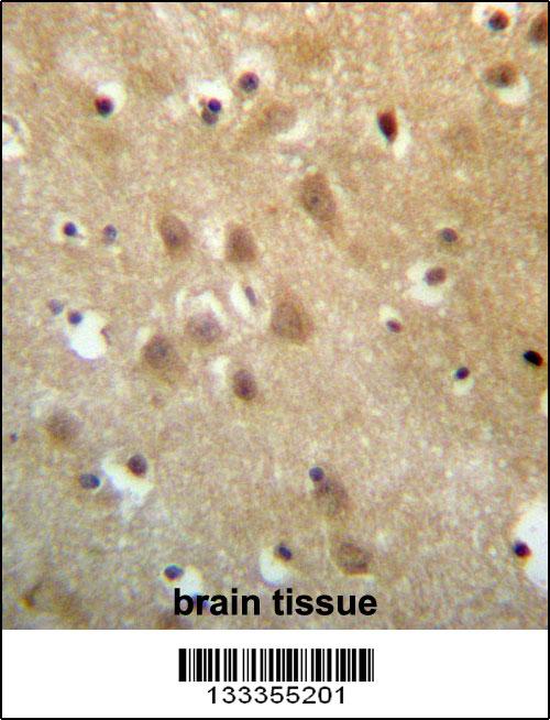 Rabbit anti-ZNF227 Polyclonal Antibody(N-term )