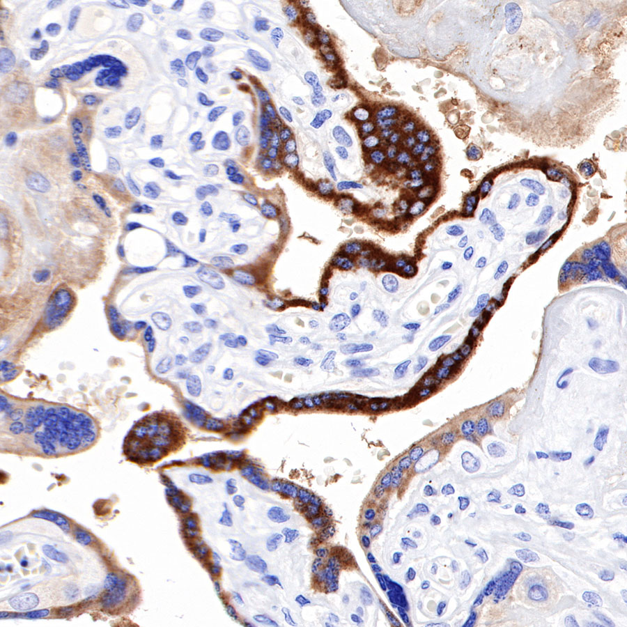 Rabbit anti-PAPP-A Recombinant Monoclonal Antibody(226-46)