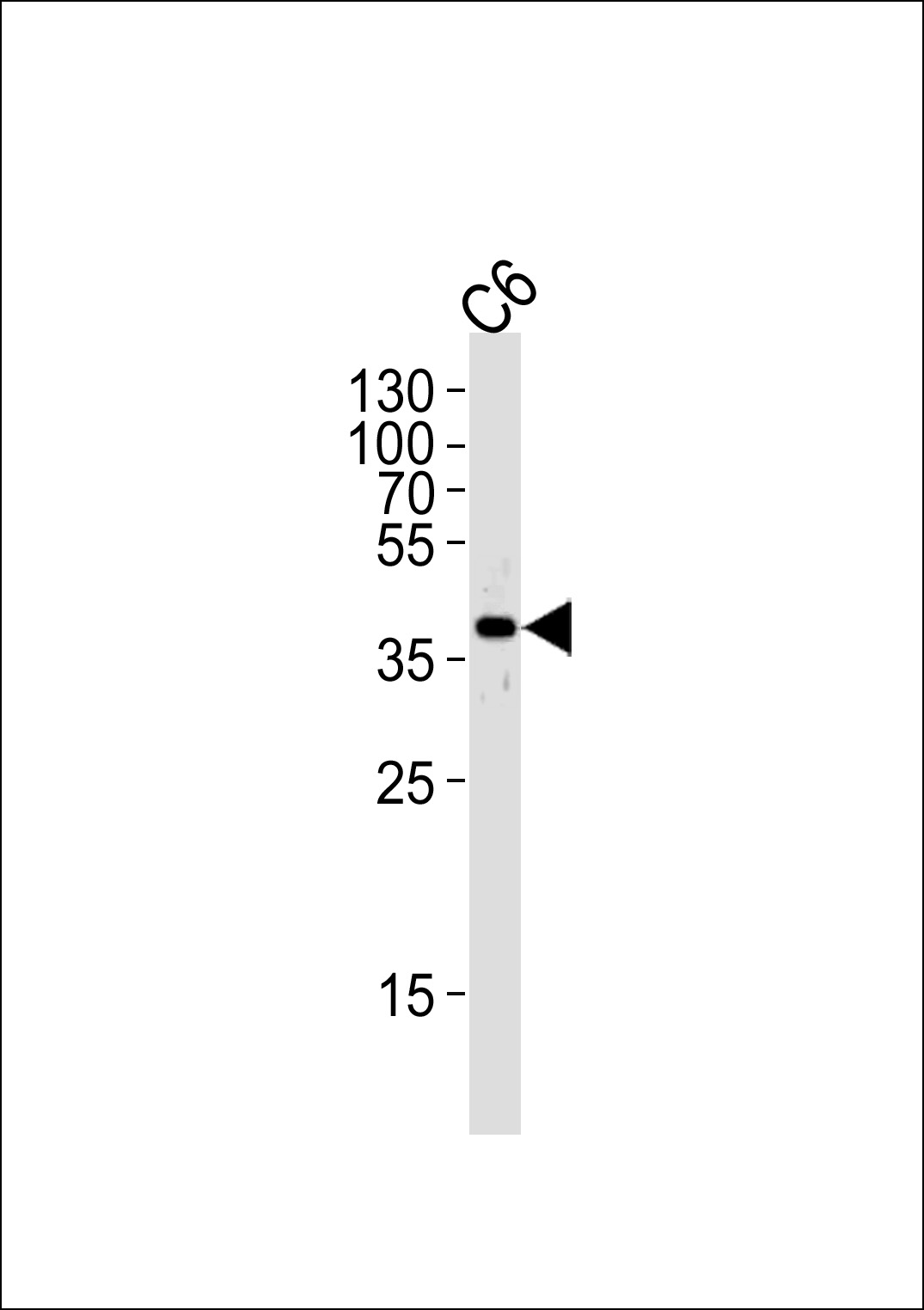 Rabbit anti-MEK1(S218/222) Polyclonal Antibody