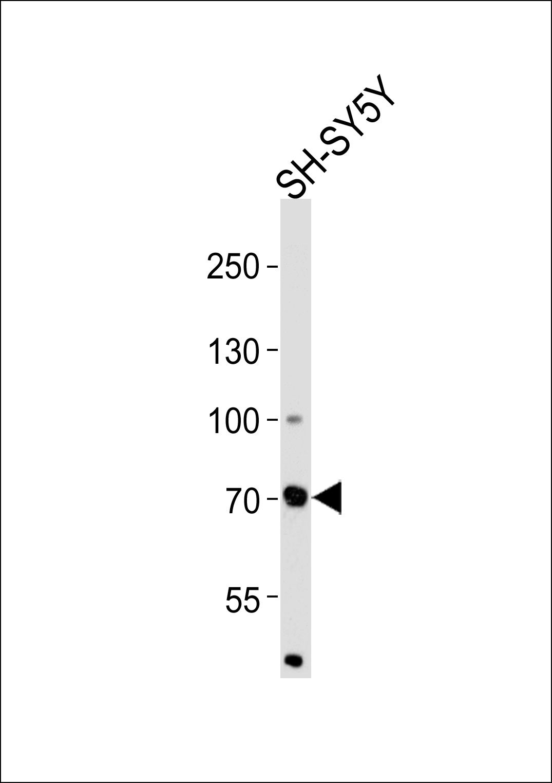 Rabbit anti-ZNF219 Polyclonal Antibody(N-term)