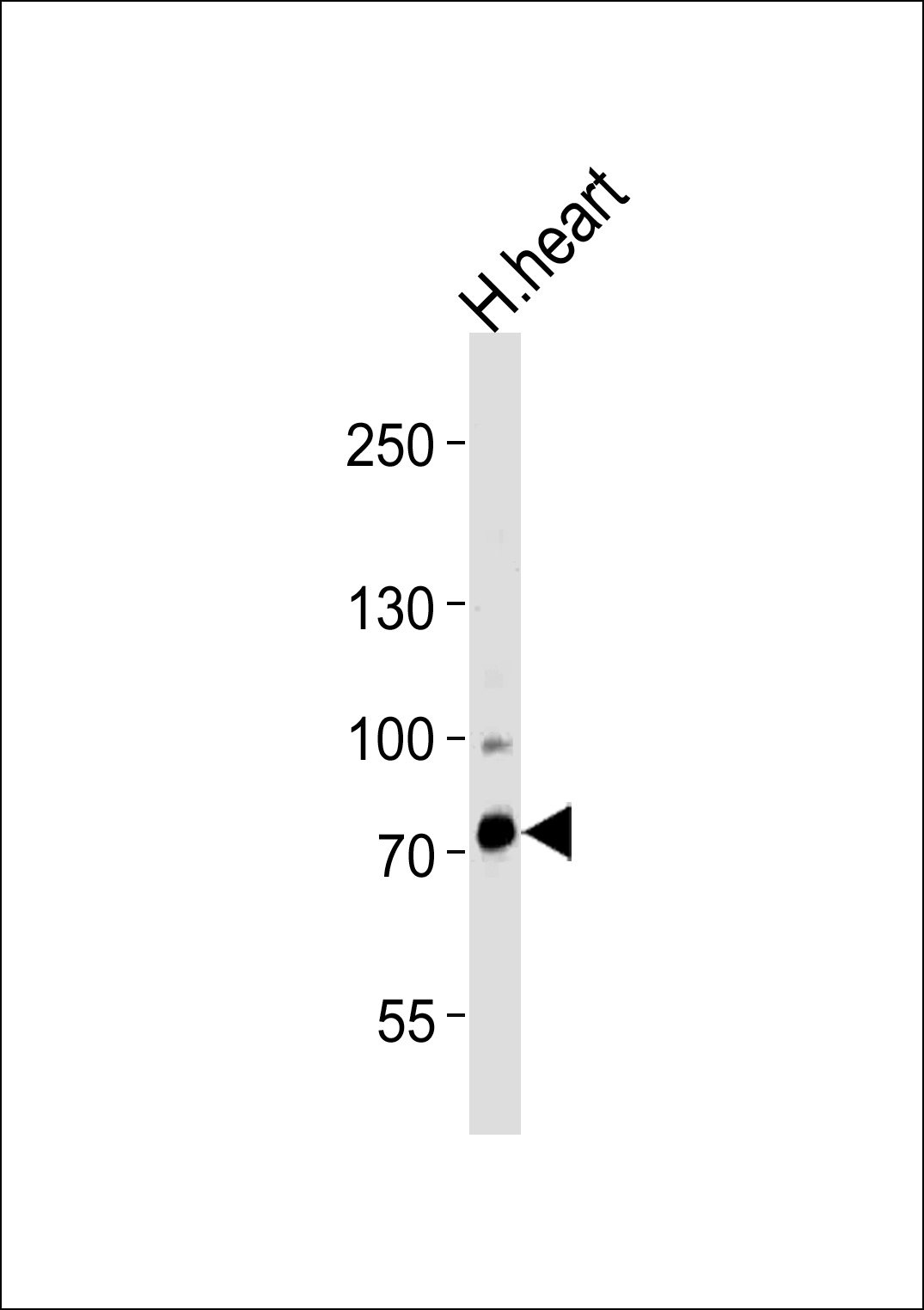 Rabbit anti-ZNF219 Polyclonal Antibody(N-term)