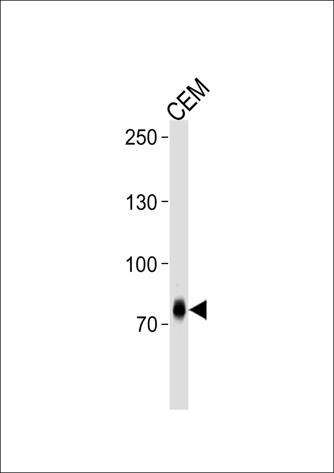 Rabbit anti-ZNF219 Polyclonal Antibody(C-term)