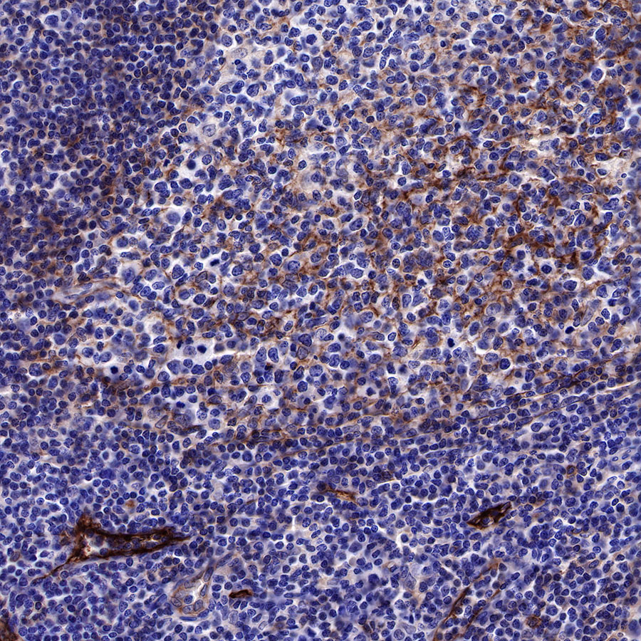 Rabbit anti-CD73 Recombinant Monoclonal Antibody(218-52)