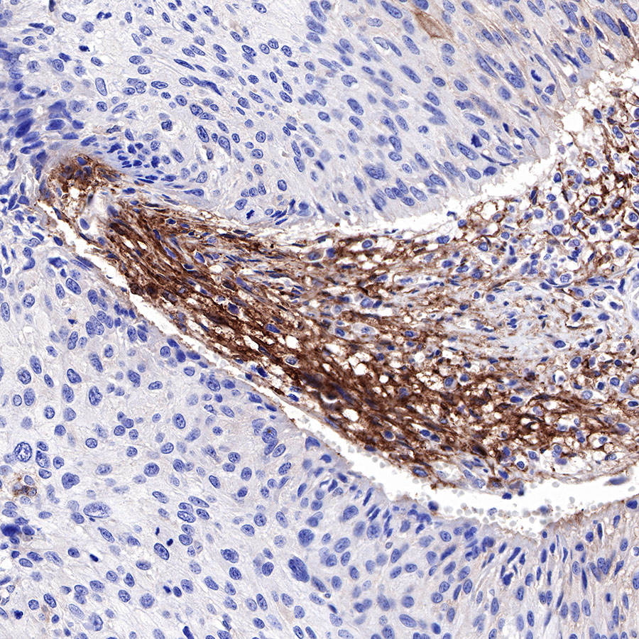 Rabbit anti-CD73 Recombinant Monoclonal Antibody(218-52)