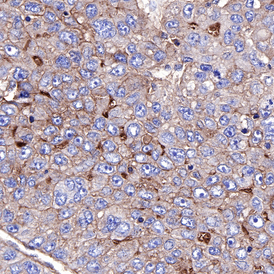 Rabbit anti-CD73 Recombinant Monoclonal Antibody(218-52)
