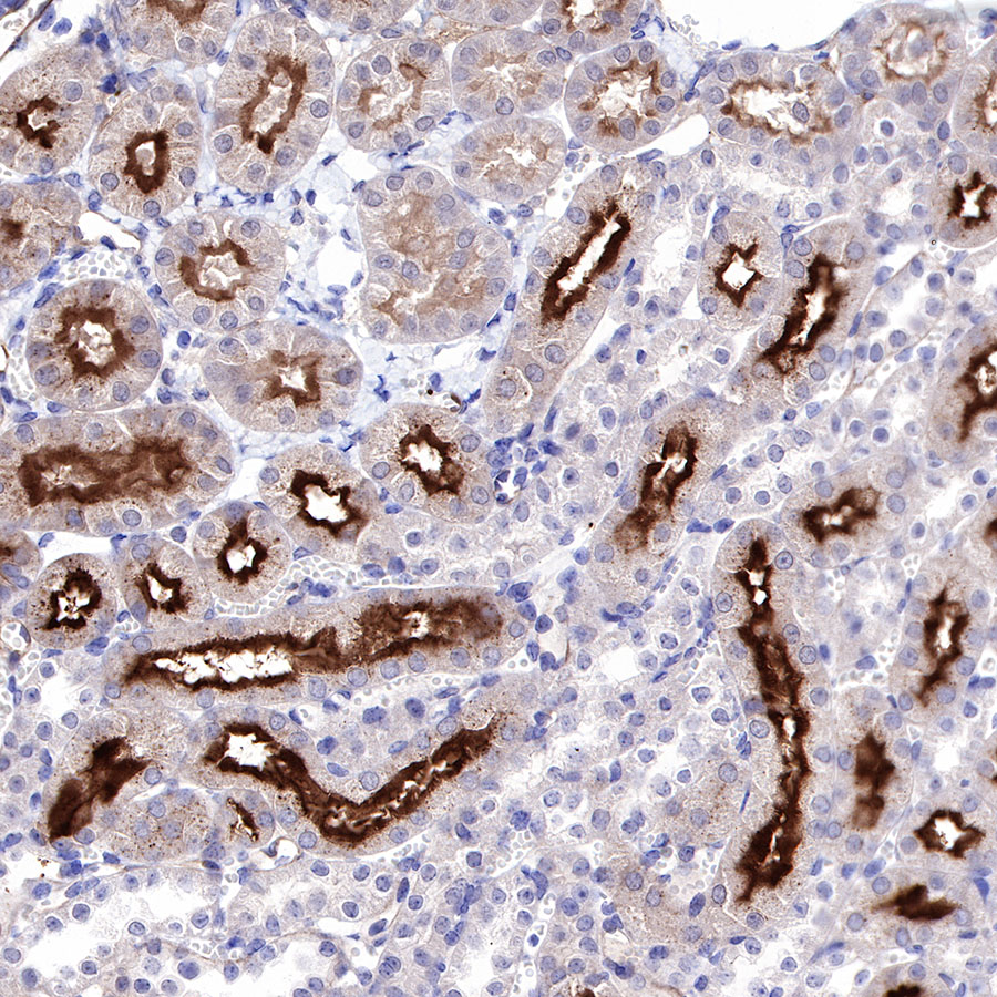 Rabbit anti-CD73 Recombinant Monoclonal Antibody(218-52)
