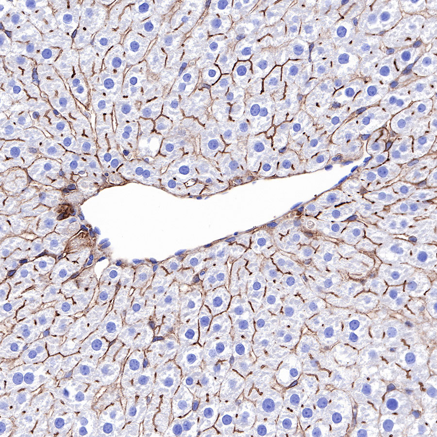 Rabbit anti-CD73 Recombinant Monoclonal Antibody(218-52)