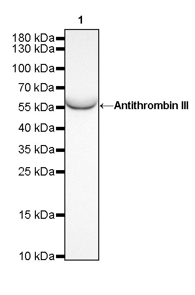 Rabbit anti-Antithrombin III Recombinant Monoclonal Antibody(294-211)