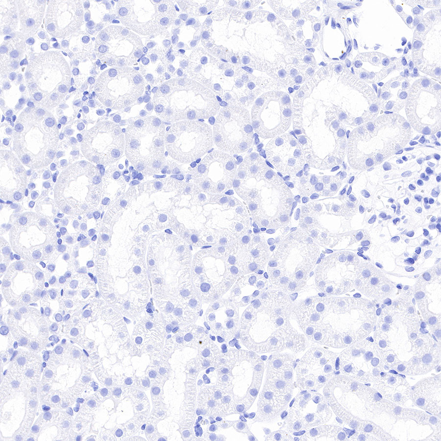 Rabbit anti-Thyroglobulin Recombinant Monoclonal Antibody(209-297)