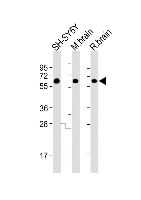 Mouse anti-DPYSL5 Monoclonal Antibody(1503CT789.209.250.52)