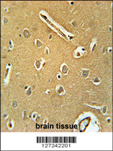 Rabbit anti-RNF208 Polyclonal Antibody(Center)