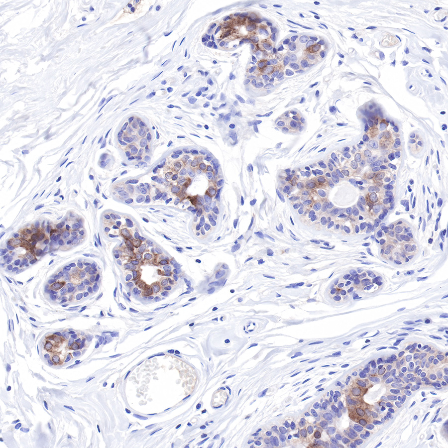 Rabbit anti-LIV-1/SLC39A6 Recombinant Monoclonal Antibody(206-84)
