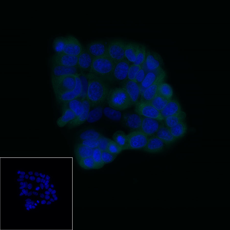 Rabbit anti-LIV-1/SLC39A6 Recombinant Monoclonal Antibody(206-84)