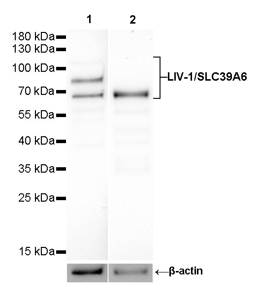 Rabbit anti-LIV-1/SLC39A6 Recombinant Monoclonal Antibody(206-8224)