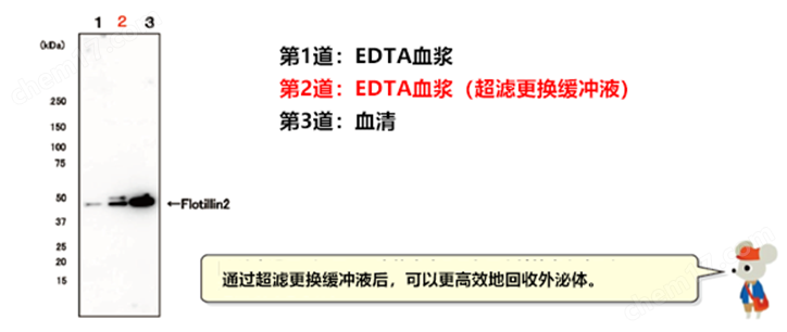 新型亲和法外泌体提取试剂盒试剂盒-Wako富士胶片和光