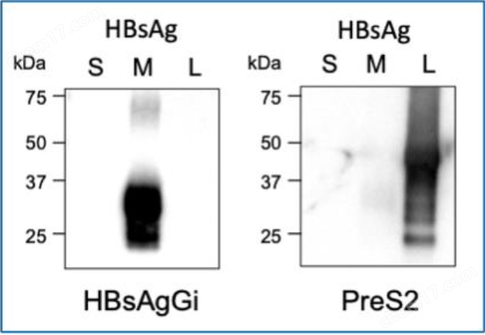 HBsAgGi抗体/HBsAgGi ELISA试剂盒生物试剂-Wako富士胶片和光