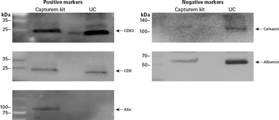 细胞外囊泡提取试剂盒Capturem&trade; Extracellular Vesicle Isolation Kit