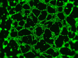 iPS向血管内皮细胞定向分化系统iPS Cell to Endothelial Cell Differentiation System