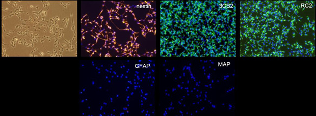 神经干细胞培养基Adherent Neural Stem Cell Culture Media