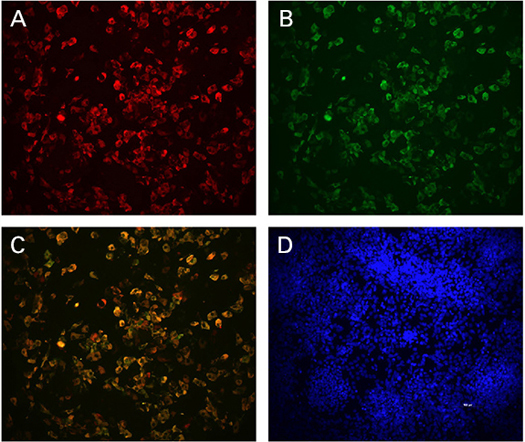 胰腺β细胞Human Stem Cell Derived Beta Cells