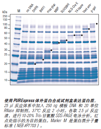 PURExpress® 体外蛋白合成试剂盒                               #E6800L 100 次反应