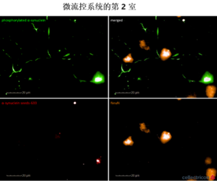 StressMarq——Alpha 突触核蛋白产品推荐（3）