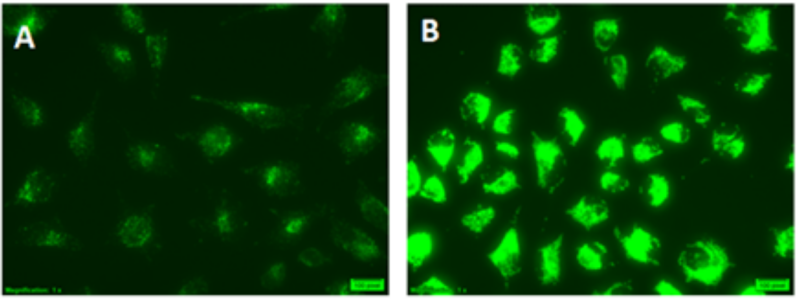 ENZO热销产品——CYTO-ID® Autophagy Detection Kit 2.0自噬检测试剂盒2.0版