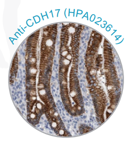 Atlas Antibodies——专注于高品质IHC抗体研发