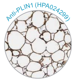 Atlas Antibodies——专注于高品质IHC抗体研发