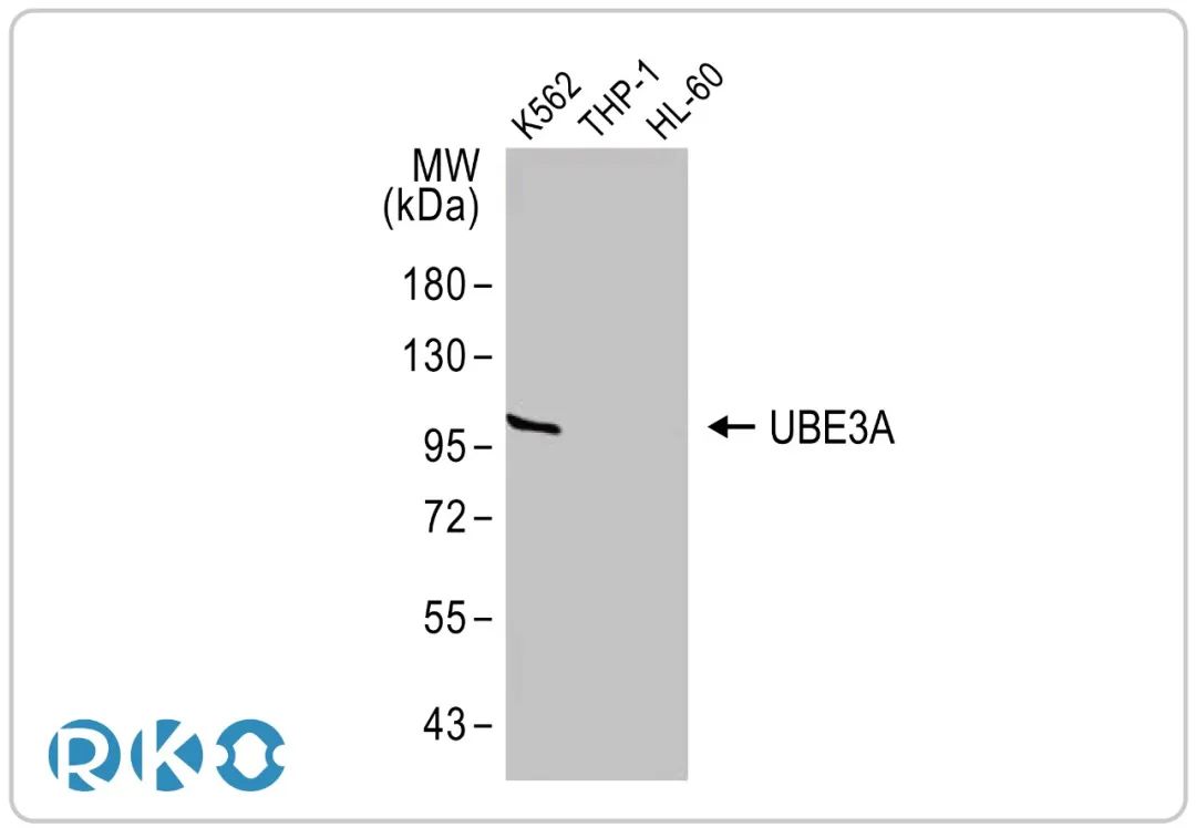 UBE3A泛素连接酶E3重组单克隆抗体