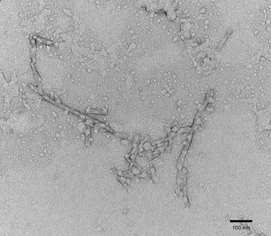 stressmarq热销产品Tau Protein stressmarq热销产品Tau Protein