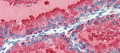 Fitzgerald热销产品——Renin antibody