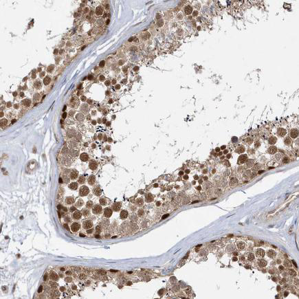 Altas Antibodies热销产品——Anti-MXI1 Antibody