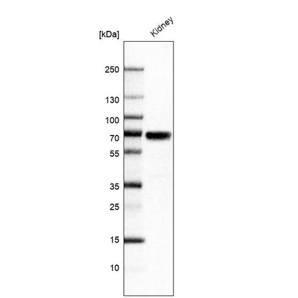 Altas Antibodies热销产品——Anti-HNF1B Antibody