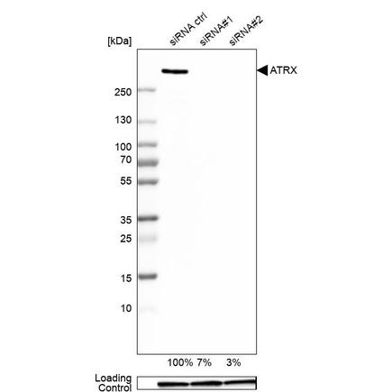 Altas Antibodies热销产品——Anti-ATRX Antibody