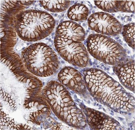 抢、 抢、 抢！Atlas Antibodies 全线产品低至7折促销