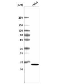 重磅消息—Atlas高品质PrecisA CT83单克隆抗体被T-cure Bioscience用于KK-LC-1肿瘤的I期临床研究