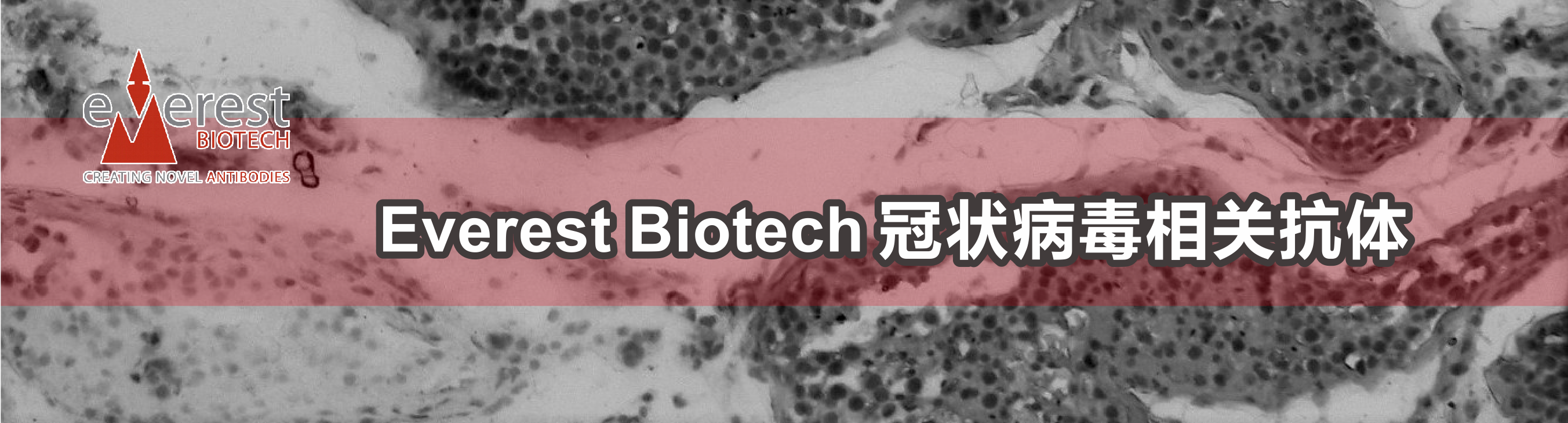 Everest Biotech 冠状病毒相关抗体