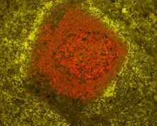 Vector® True VIEW™ Autofluorescence Quenching Kit