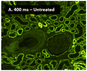 Vector® True VIEW™ Autofluorescence Quenching Kit