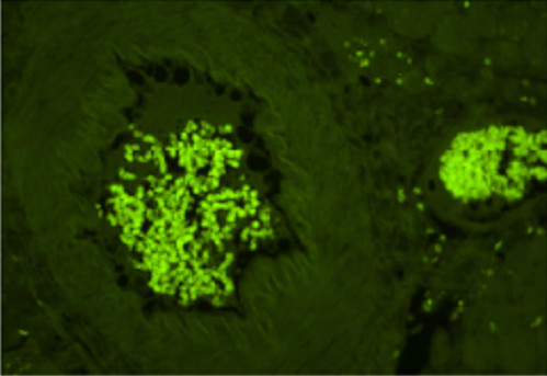 Vector® True VIEW™ Autofluorescence Quenching Kit