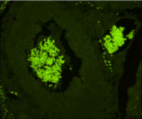 Vector® True VIEW™ Autofluorescence Quenching Kit
