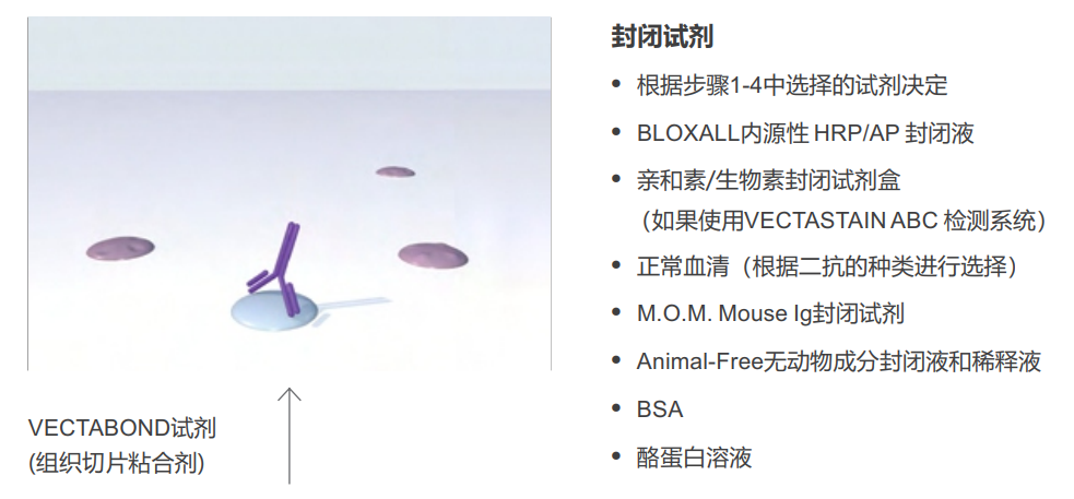 免疫组织化学选择指南